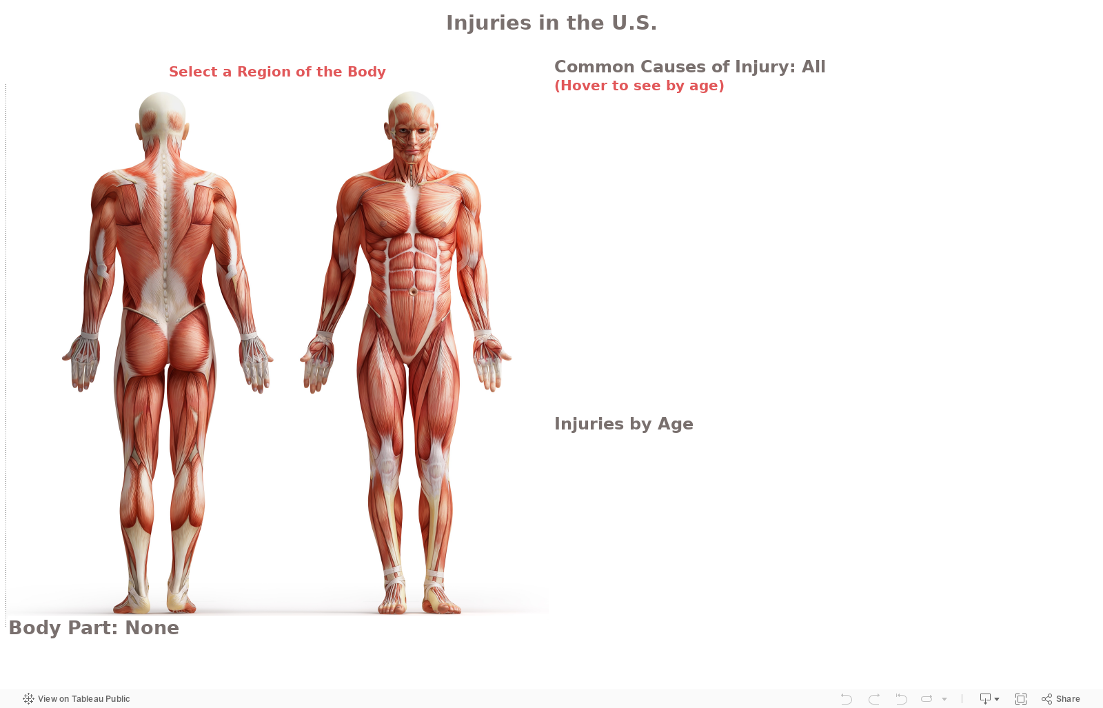 Injuries in the U.S. 